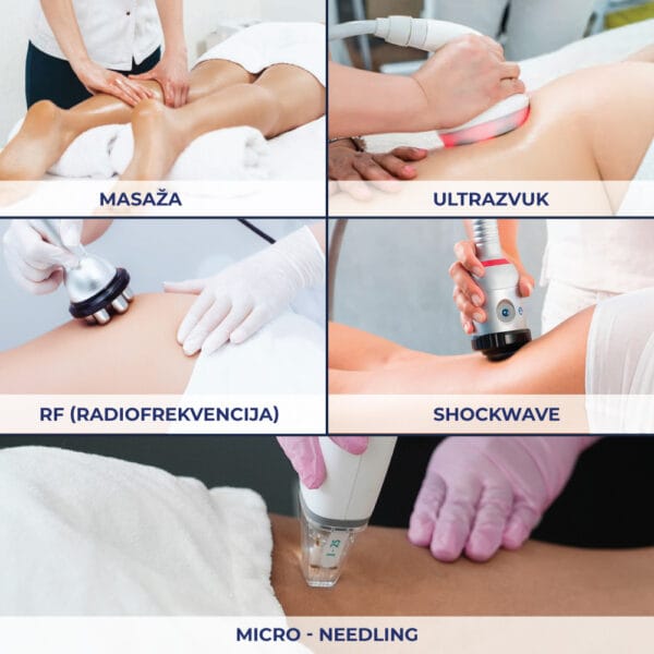 Serum za Strije – 150 ml – Anesi Lab