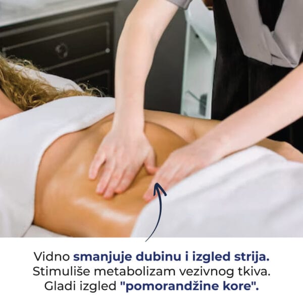 Serum za Strije – 150 ml – Anesi Lab