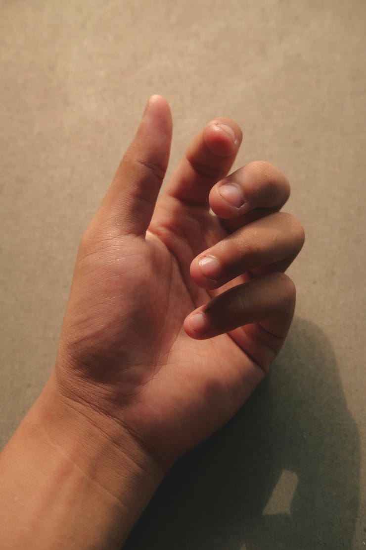 Neadekvatno negovani nokti